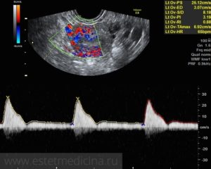 Доплер сосудов матки