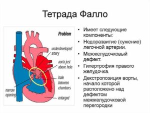 ВПР ВПС Тетрадо Фало