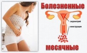 Ужасные боли в первый день месячных