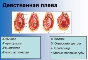 Девственная плева, боль.