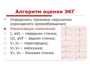 Нарушение кровообращения задней стенки