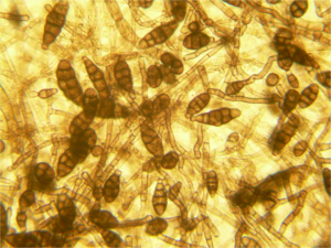 Cladosporium herbarum. Alternaria alternata