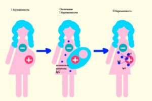 Вторая беременность при отрицательном резусе мамы