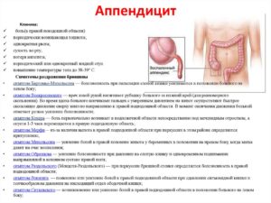 Может ли аппендицит болеть 3 дня? Сильной боли нет она уменьшается