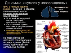 Врожденный порок сердца- ООО