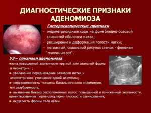 Микроаденоматоз тела матки