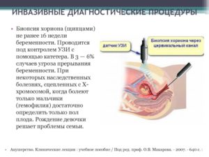 Узи при беременности и угроза прерывания