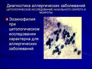 Микроскопическое исследование назального секрета