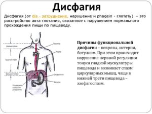 Дисфагия или нервы?