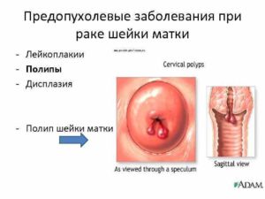 Может ли быть эритроплакия на слизистой вульвы