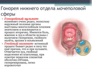 Вылечил ли я гонорею цифраном?