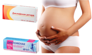 Диклофенак при планировании беременности