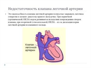 Дисфункция клапана лёгочной артерии