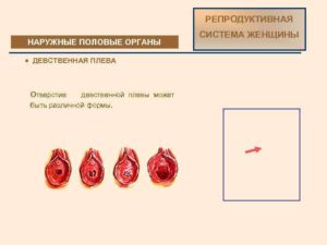 Может ли сохраниться девственность, не до конца прорваться плева?