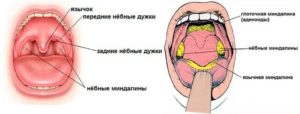 Дырка на небно глоточной дужке болит