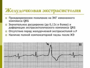 Экстрасистолия с утра на тощак