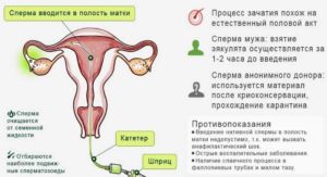 Вероятность беременности, сперма, жизнеспособность сперматозоидов