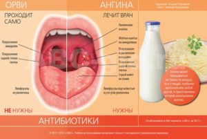 На языке постоянно налет и при простуде часто болит горло