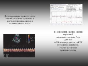 Доплер сосудов матки