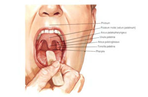 Воспаление миндалины справа. Боли при открывании рта
