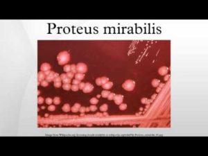 В носу выявлен proteus mirabilis