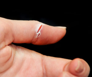 Высох палец после раны