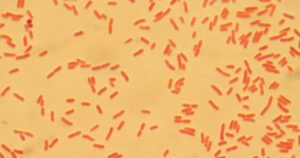 В мазке из глаз обнаружена Escherichia coli. Насколько это серьёзно?