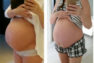Напряжен живот при беременности