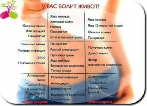 Ужасные опоясывающие боли внизу живота