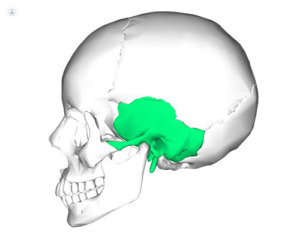 Деформация черепа чуть выше височной кости, начались головные боли