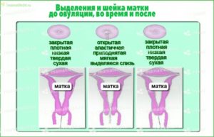 Мучает боль во время овуляции