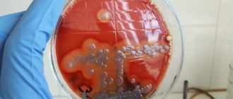 E. Coli в простате