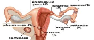 Возможность внематочной беременности