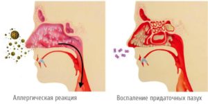 Выделения скапливаються и стекают по задней стенки глотки