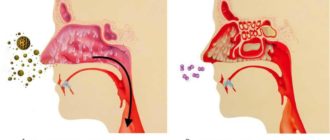 Выделения скапливаються и стекают по задней стенки глотки