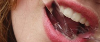 Вич кровь во рту