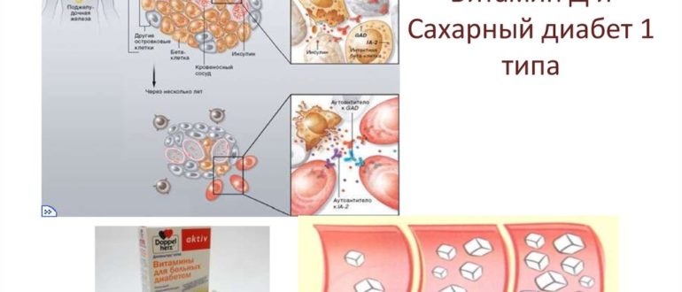 Витамин д и сахарный диабет 1 типа