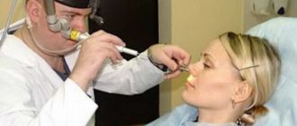 Вазомоторный ринит перед поступлением в военный вуз