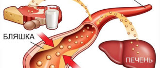 Высокий холестерин, гамма гт, гастрит