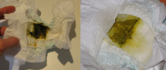 Выделения через полтора месяца после родов