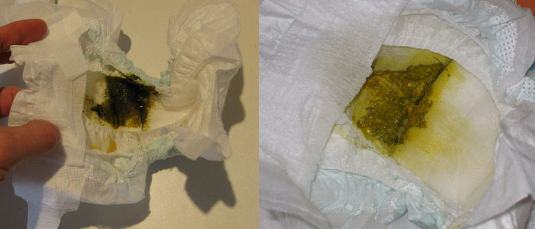 Выделения через полтора месяца после родов