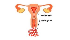 Месячные начались и сразу закончились