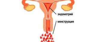 Месячные начались и сразу закончились