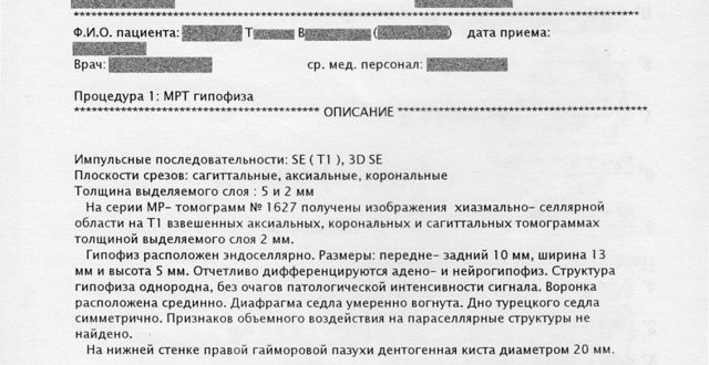 МРТ гипофиза помогите расшифровать