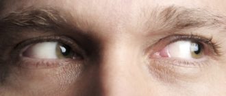Напряжение в левом глазу. Тяжело водить глазами