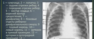 Частые рентгены органов грудной клетки ребёнку в 2 года