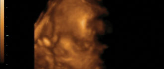 Узи в 30 недель с доплером