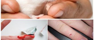 Моего ребенка укусила мышь