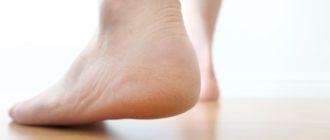 Чешется тыльная сторона стоп и пятка