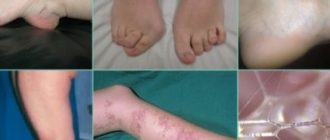 Дст и последствия